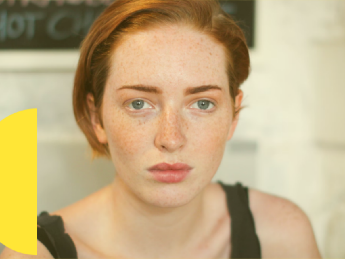 Red Flushed Face Symptoms